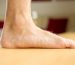 piedi piatti
